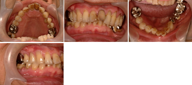 噛み合わせと矯正 噛み合わせと矯正
