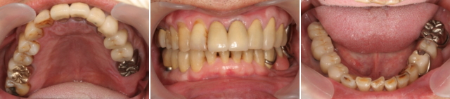 治療した状態が長く持って、安定していることが患者さんと診療室のゴール 治療した状態が長く持って、安定していることが患者さんと診療室のゴール