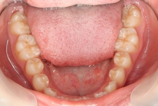 14歳の妹さん 14歳の妹さん