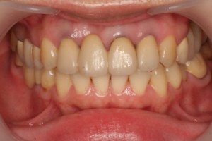 初診時の写真 初診時の写真