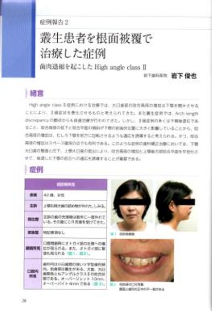 治療例が載りました