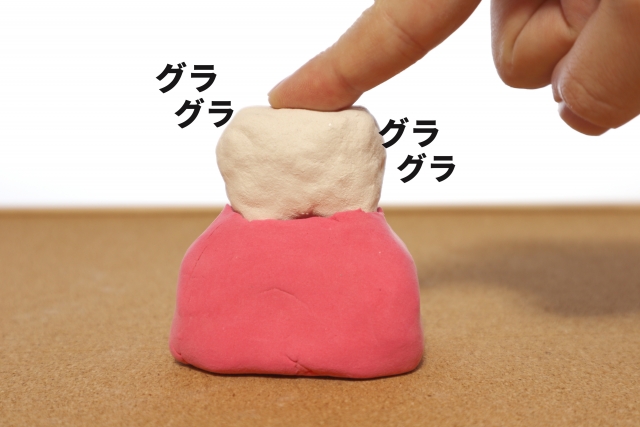 欠損歯の放置 欠損歯の放置